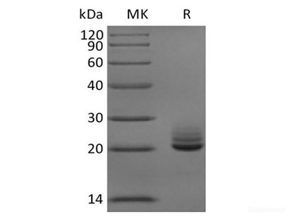 Recombinant Mouse Fibroblast Growth Factor 21/FGF-21 (C-6His) (RPES6654)