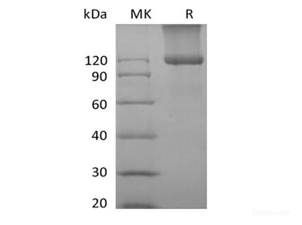Recombinant Mouse TGFBR3 (C-6His) (RPES6656)
