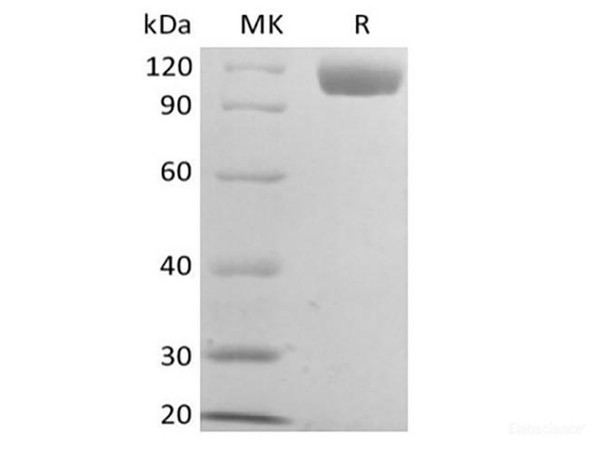 Recombinant Mouse B-cell Receptor CD22/Siglec-2/CD22 (C-6His) (RPES6659)