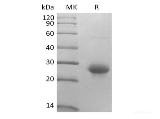 Recombinant Mouse CD27 Ligand/TNFSF7/CD70 (N-10His) (RPES6662)