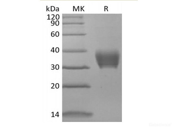 Recombinant Mouse BTNL4 (C-6His) (RPES6681)