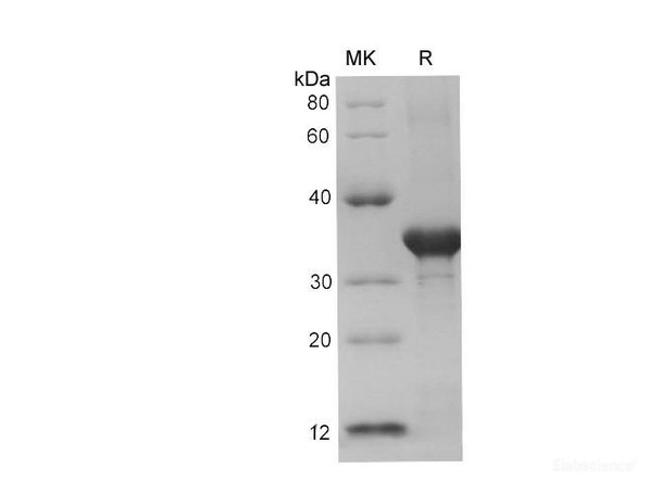 Mouse Chromogranin-A/Chga Recombinant Protein (His Tag) (RPES6745)
