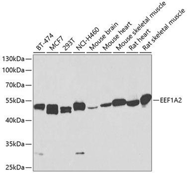 Anti-EEF1A2 Antibody (CAB2473)