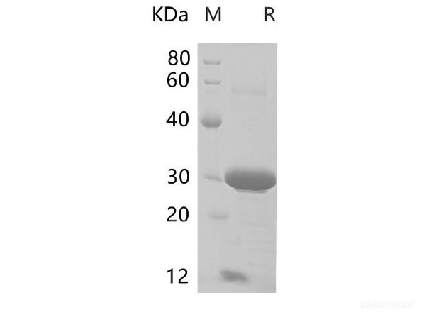 Mouse CD74 Recombinant Protein (His Tag) (RPES6749)