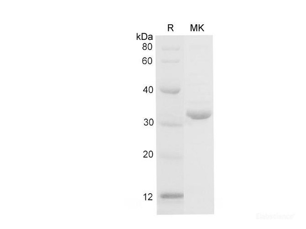 Mouse Galectin-3/Lgals3 Recombinant Protein (His Tag) (RPES6751)