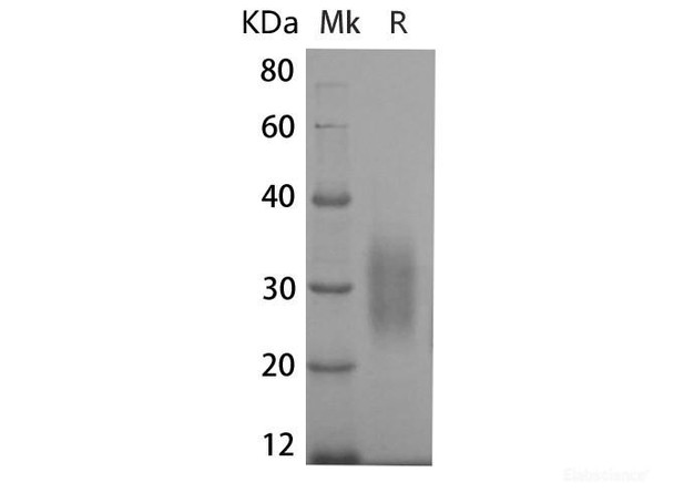 Mouse IL-22 Recombinant Protein (RPES6757)