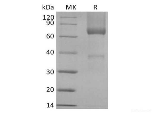 Recombinant Rhesus Macaque Glypican-3/GPC3/OCI5 (C-6His) (RPES6773)
