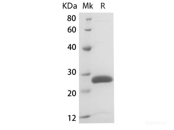 Rat IL-6 Recombinant Protein (RPES6834)