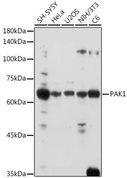 Anti-PAK1 Antibody (CAB2554)