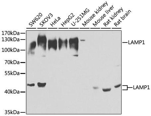 Anti-LAMP1 Antibody (CAB2582)