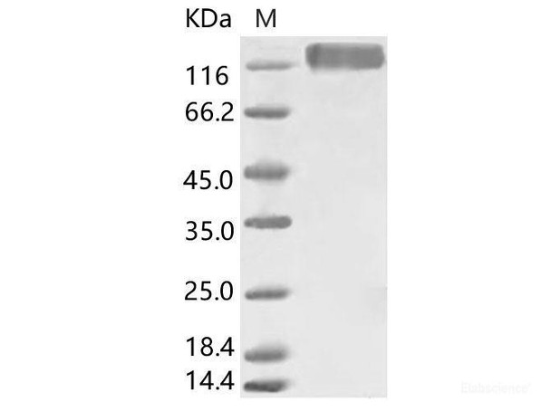 HCoV-229E S1+S2 Recombinant Protein (ECD, His Tag) (RPES6879)