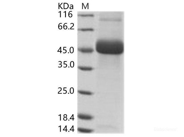 DENV (type 2, strain New Guinea C) NS1 Recombinant Protein (His Tag) (RPES6888)