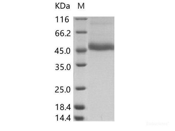DENV (type 3, strain Philippines/H87/1956) NS1 Recombinant Protein (His Tag) (RPES6893)