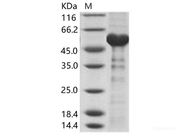 Dromedary camel coronavirus (DcCoV) (strain HKU23-368F) NucleoRecombinant Protein / DcCoV-NP Recombinant Protein (His Tag) (RPES6898)