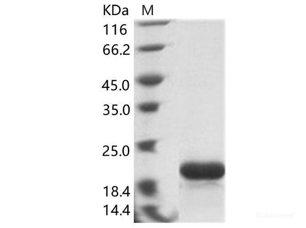 EBOV (subtype Zaire, strain H.sapiens-wt/GIN/2014/Kissidougou-C15) NucleoRecombinant Protein / NP Recombinant Protein (His Tag) (RPES6923)