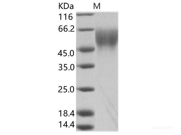 EBOV (subtype Zaire, strain Mayinga 1976) GP-RBD / GlycoRecombinant Protein Recombinant Protein (RPES6929)