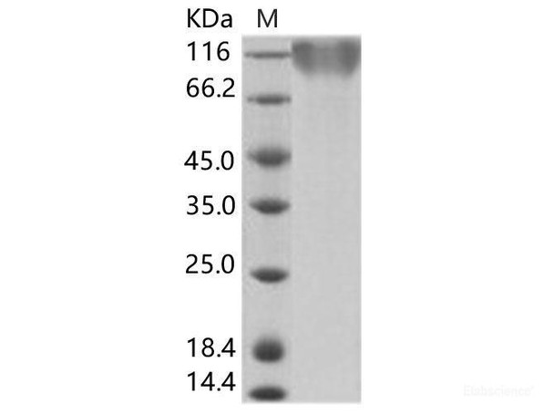 Epstein-Barr virus (Herpesvirus 4) EBV GlycoRecombinant Protein gp350 / EBV GP350 Recombinant Protein (His Tag) (RPES6936)