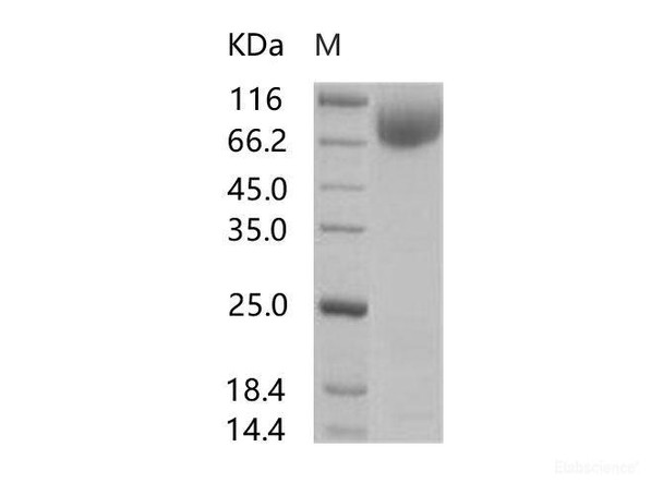 HIV-1 gp140 Recombinant Protein (group M, subtype A, strain 92UG037.1) (Fc Tag) (RPES6950)
