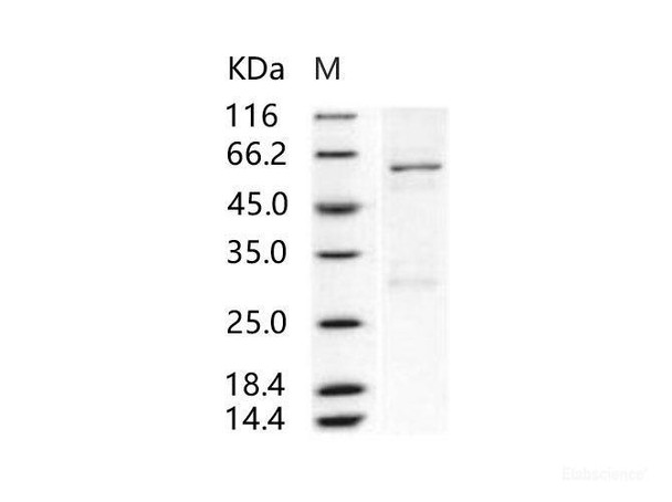 Human Enterovirus 71 VP0 Recombinant Protein (His & GST Tag) (RPES6973)