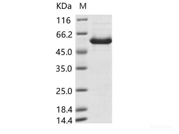 Human mastadenovirus B (HAdV-B) encapsidation Recombinant Protein IVa2 (His Tag) (RPES6976)