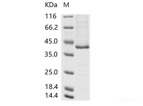 Recombinant Human mastadenovirus E (HAdV-E) fiber Recombinant (His Tag) (RPES6977)