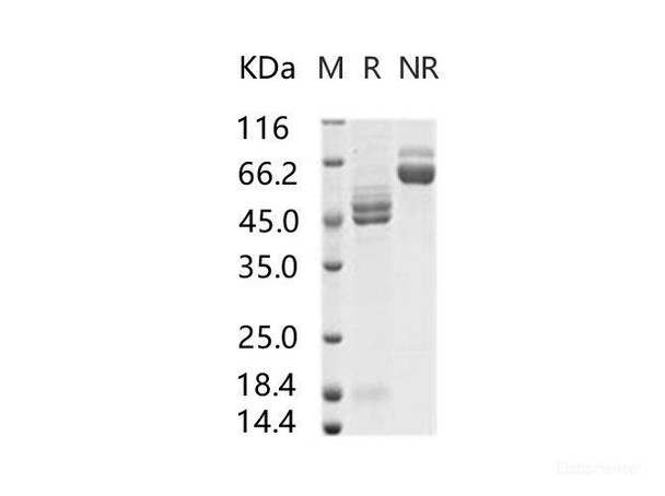 RSV (A2) Fusion glycoRecombinant Protein / RSV-F Recombinant Protein (His Tag) (RPES6981)