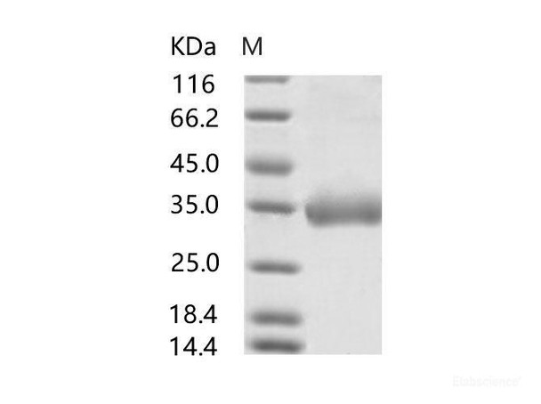 MERS-CoV Spike/RBD Recombinant Protein fragment (RBD, aa 367-606, His Tag), Biotinylated (RPES6988)