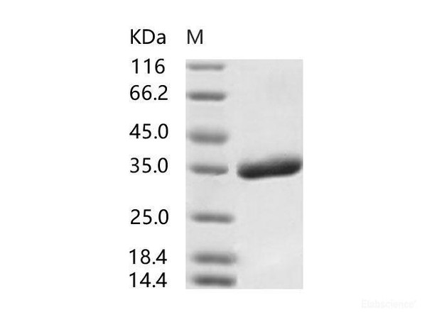 SARS-CoV Spike/RBD Recombinant Protein (RBD, His Tag), Biotinylated (RPES7001)