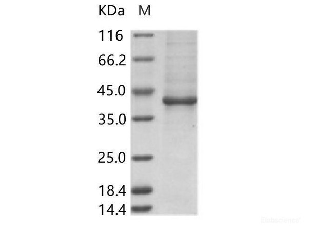 ZIKV (strain Zika SPH2015) Envelope Recombinant Protein (Domain III, Fc Tag) (RPES7017)