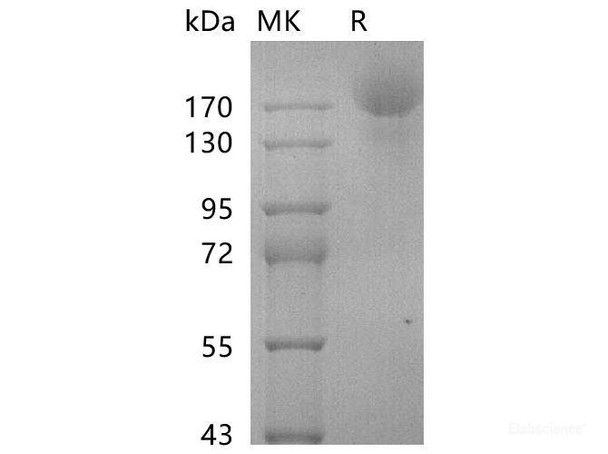 SARS-CoV-2 S-stable trimer Recombinant Protein (C-6His) (Active) (RPES7042)