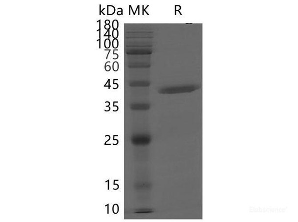 SARS-CoV-2 NSP15 Recombinant Protein (RPES7055)
