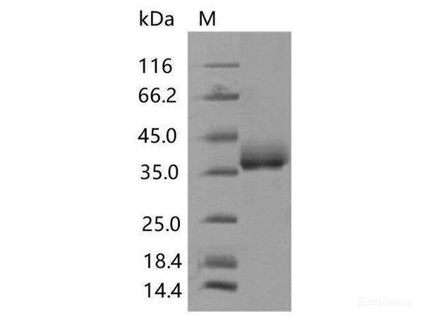 Recombinant SARS-CoV-2 Spike RBD (N501Y) (His Tag), Biotinylated (RPES7079)