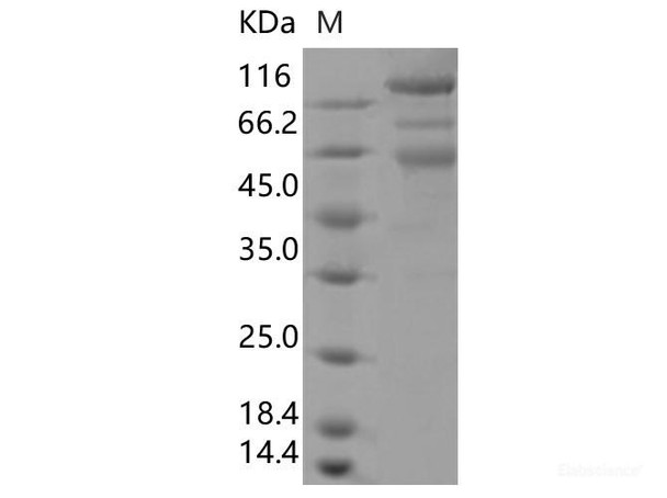 Recombinant SARS-CoV-2 Spike S1+S2 ECD (D80A, K417N, E484K, N501Y, D614G, A701V) (His Tag) (RPES7086)