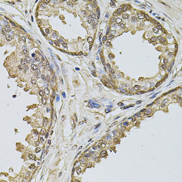 Anti-Cyclin A2 Antibody (CAB2891)