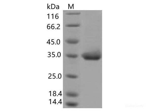 Recombinant SARS-CoV-2 Spike RBD (E484K) (His Tag) (RPES7092)