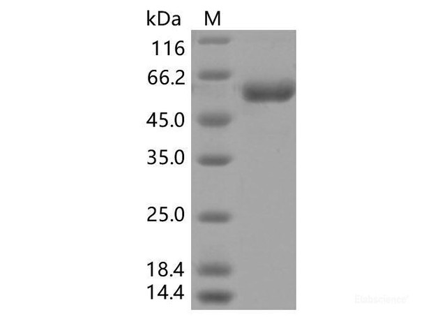 Recombinant SARS-CoV-2 Spike RBD (K417T) (rFc Tag) (RPES7106)