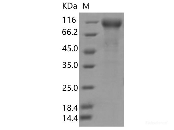 Recombinant SARS-CoV-2 Spike S1(Î”HV69-70, N439K, D614G) (His Tag) (RPES7126)