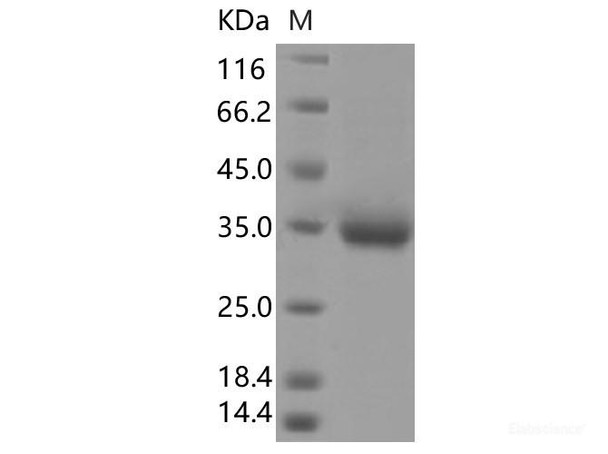 Recombinant SARS-CoV-2 Spike RBD (P384L) (His Tag) (RPES7147)