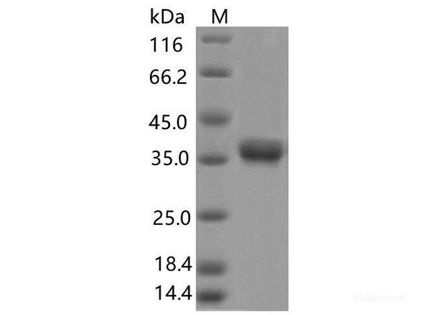 Recombinant SARS-CoV-2 Spike RBD (V395I) (His Tag) (RPES7170)
