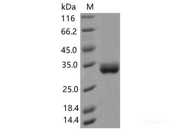 Recombinant SARS-CoV-2 Spike RBD (A475V) (His Tag) (RPES7171)