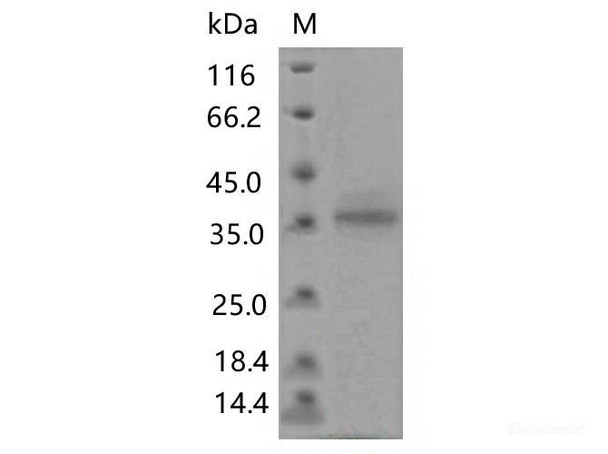 Recombinant SARS-CoV-2 Spike RBD (F456L) (His Tag) (RPES7186)