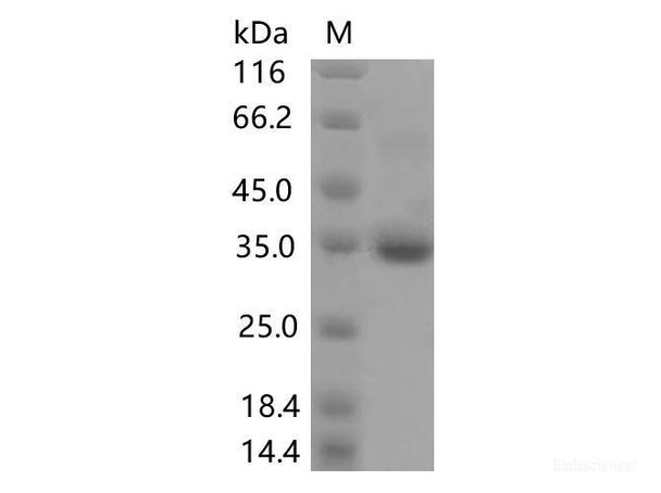 Recombinant SARS-CoV-2 Spike RBD (V445F) (His Tag) (RPES7193)