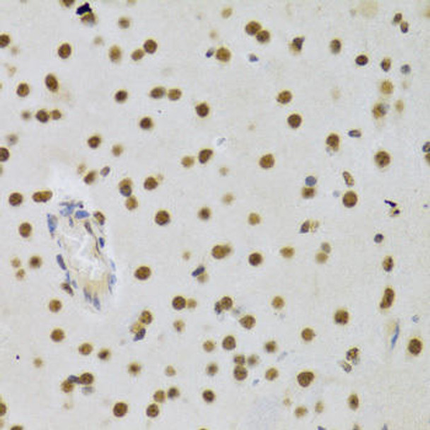 Anti-DNMT3A Antibody (CAB3169)