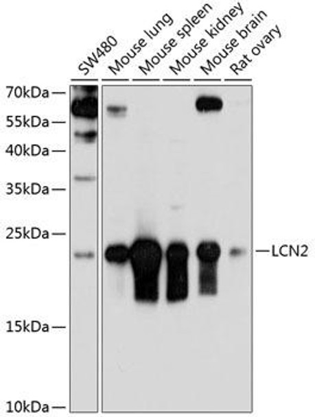 Anti-LCN2 Antibody (CAB3176)