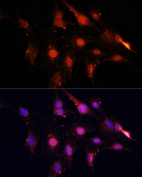 Anti-NSUN2 Antibody (CAB3443)