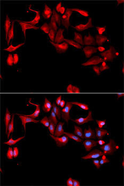 Anti-GP9 Antibody (CAB5374)