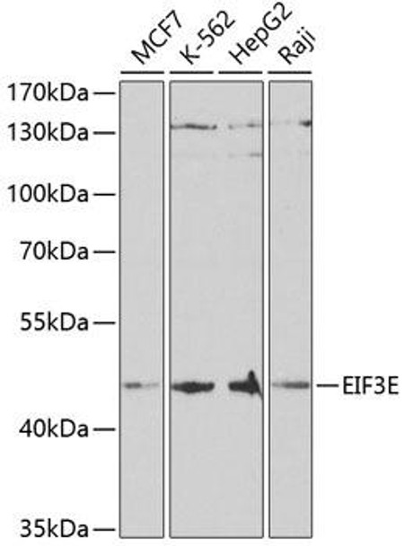 Anti-EIF3E Antibody (CAB5447)
