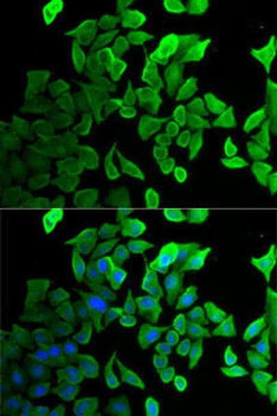 Anti-SEPT2 Antibody (CAB5801)