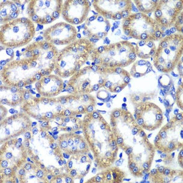 Anti-TMED10 Antibody (CAB6771)