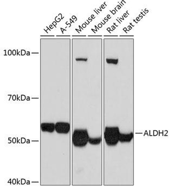 Anti-ALDH2 Antibody (CAB11500)